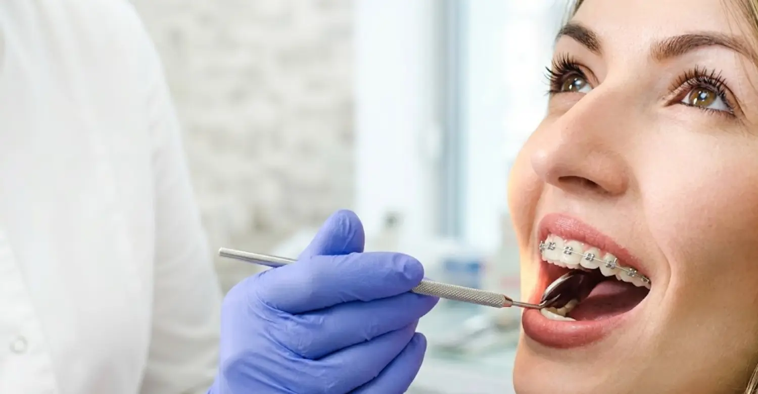Orthodontic Follow Up 2